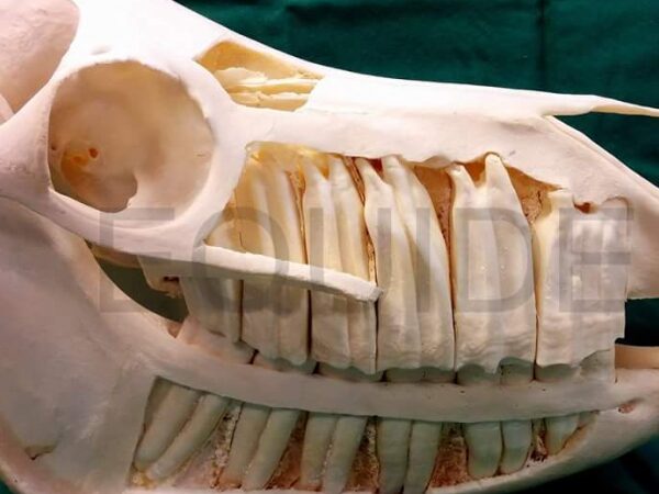 tanden 1